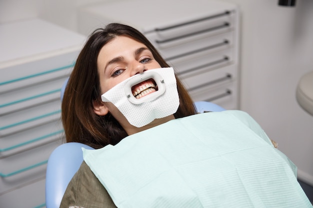 Young woman sitting in chair of dentist prepared for procedure of teeth whitening.