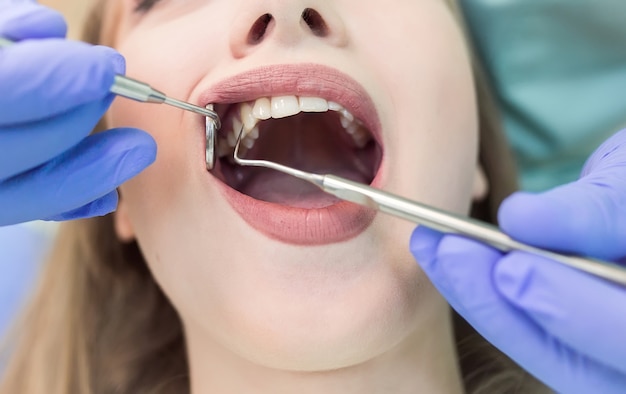 young woman sitting in the dentist's chair with opened mouth at dentist's office while having examination.