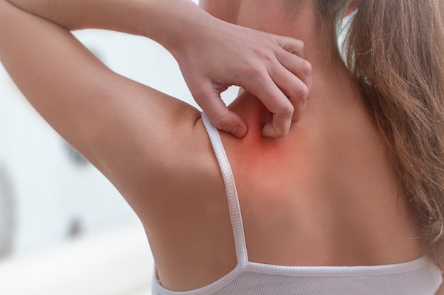 Young woman suffering from itching on her skin and scratching an itchy place. 