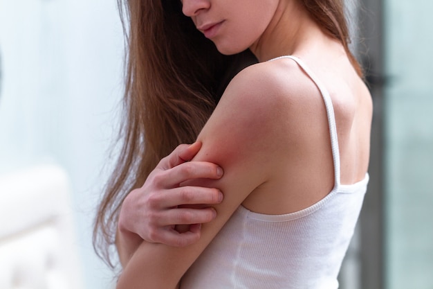 Young woman suffering from itching on her skin and scratching an itchy place. 