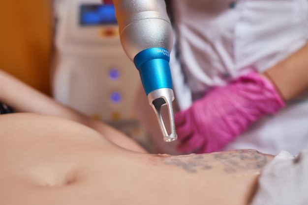 Young woman undergoing laser tattoo removal procedure in salon closeup