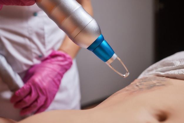 Young woman undergoing laser tattoo removal procedure in salon closeup