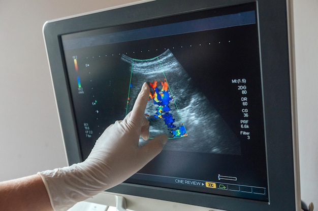 Young woman undergoing ultrasound scan in clinic