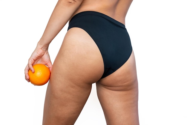 Young woman with cellulite and white stretch marks holding an orange in her hand. Excess weight