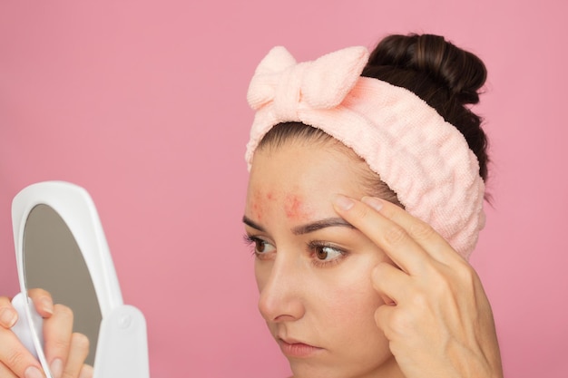 Photo young woman with a pink headband examines the pimples on her forehead looking at a white mirror