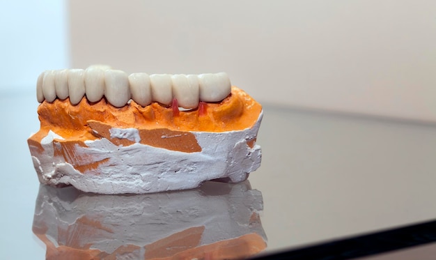 Zirconium Porcelain Tooth plate in Dentist Store Photo