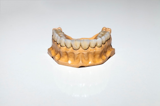 Zirconium Porcelain Tooth plate in Dentist Store Photo