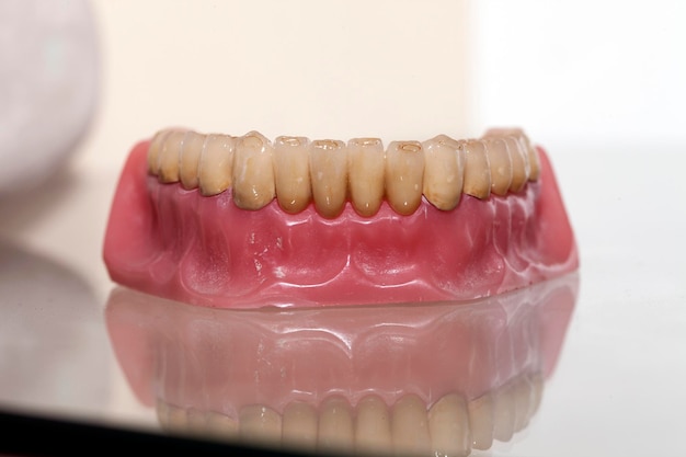 Zirconium Porcelain Tooth plate in Dentist Store Photo