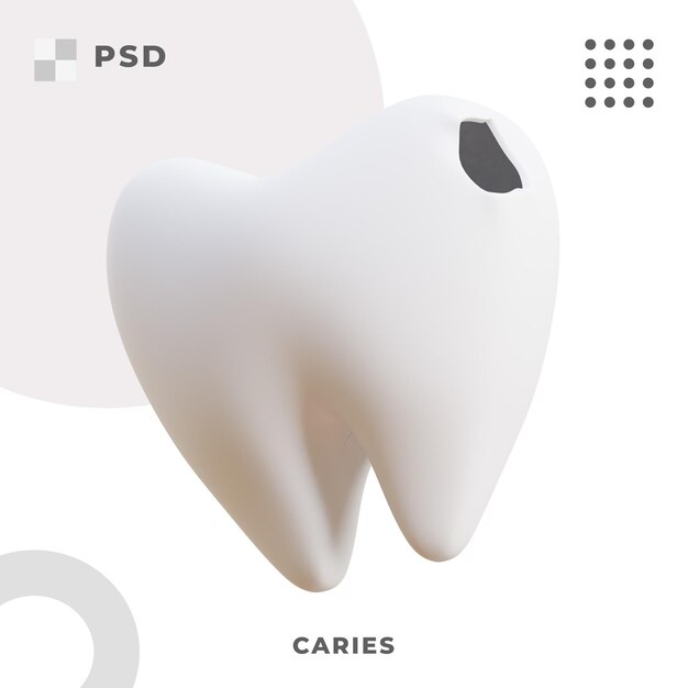 Caries Tooth