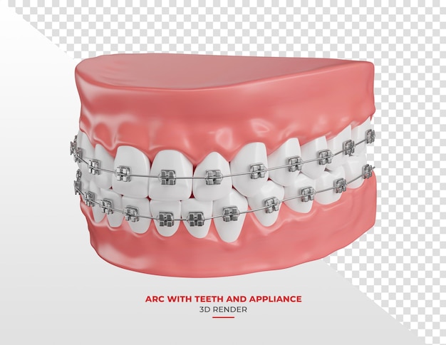 PSD dental arch with white teeth and braces in 3d render with transparent background