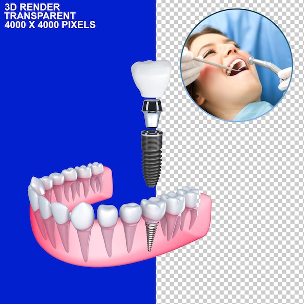 Dental Treatment Dental Braces Dental Implant Dental Observation Dental Checking Tooth Ache Dentist