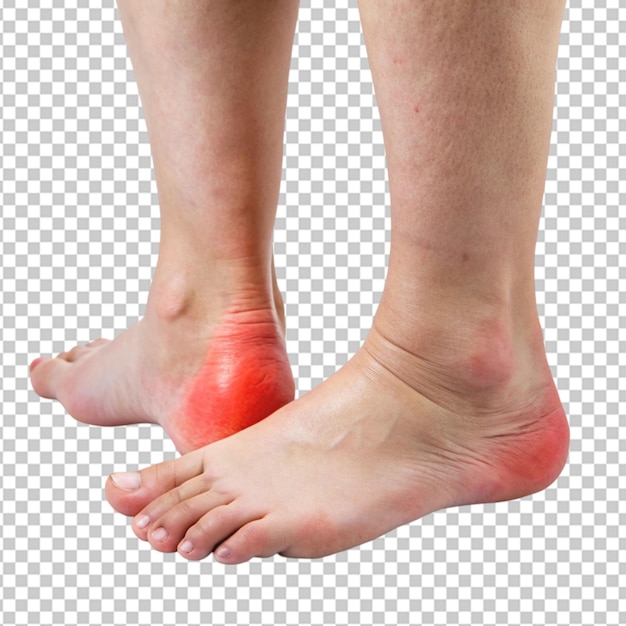 PSD female swollen ankles pictures on transparent background