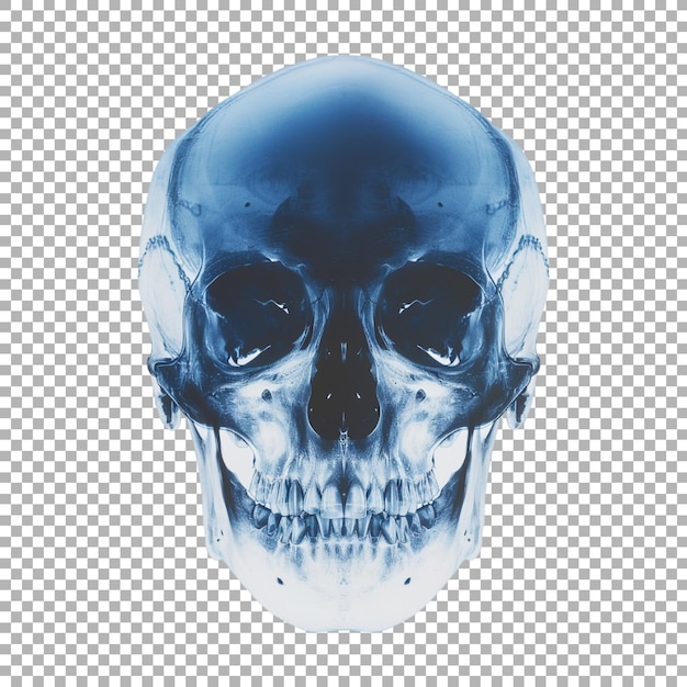 Human Skull Xray on Transparent Background Ai Generated