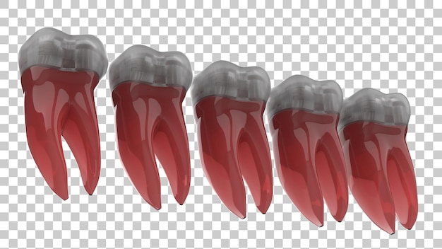 Implant tooth isolated on transparent background 3d rendering illustration