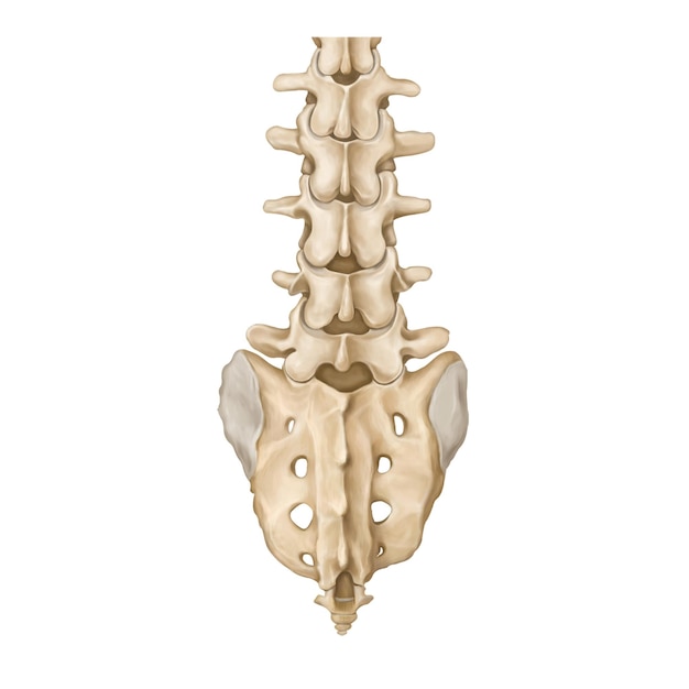 PSD lumbar spine