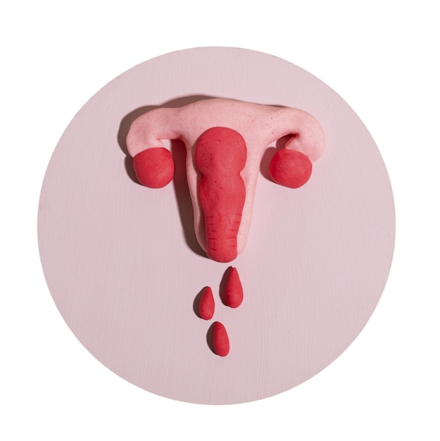 PSD ovaries and uterus shape isolated