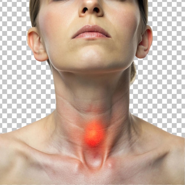 PSD picture of swollen thyroid