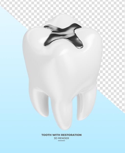 Tooth with restoration in 3d render with transparent background