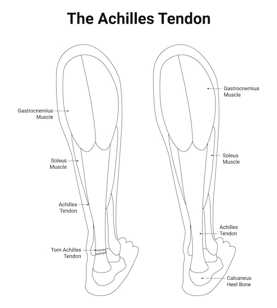 Vector the achilles tendon