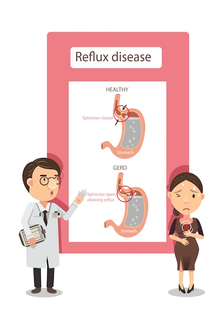 Acid Reflux disease illustration