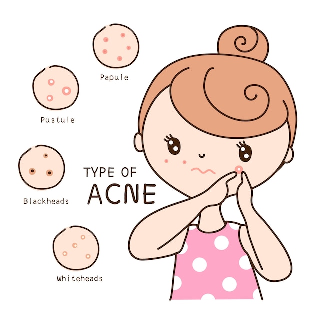 Acne type on the face