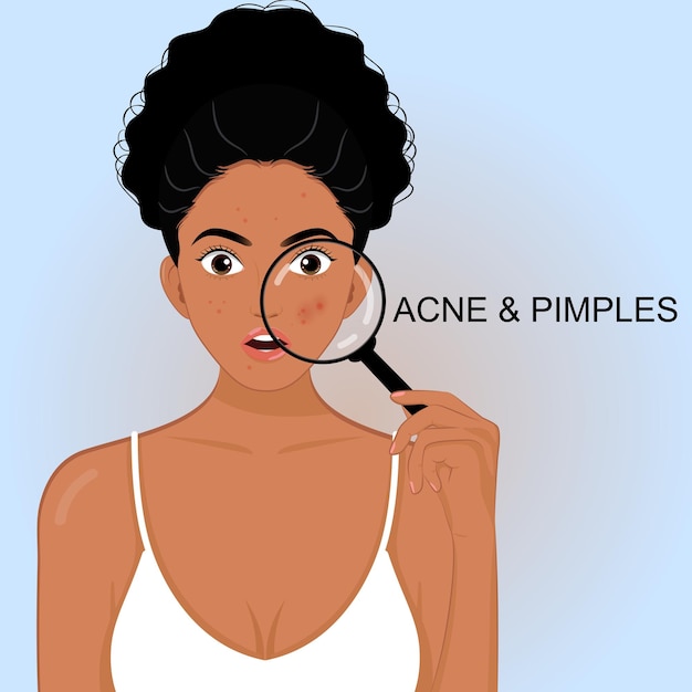 African girl holding a magnifying glass with skin problems acne pimples skincare facial treatment