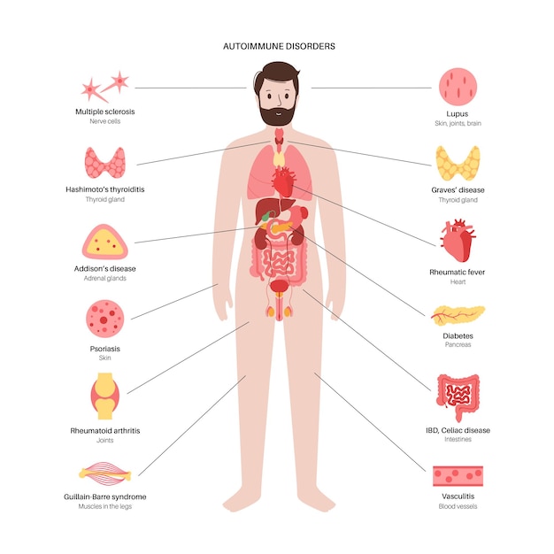 Autoimmune disorders diseases