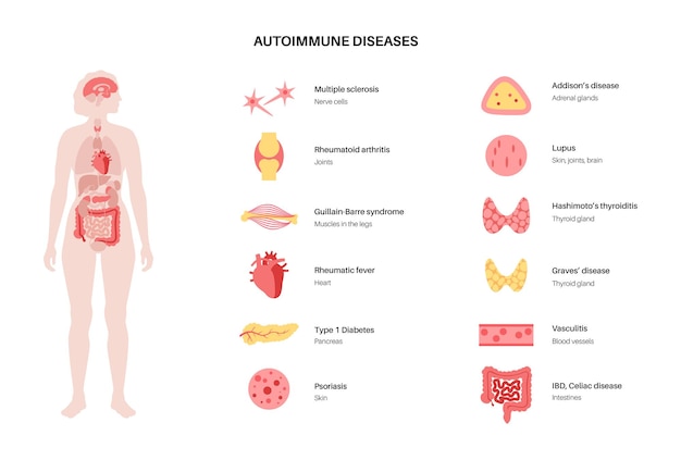 Autoimmune disorders diseases