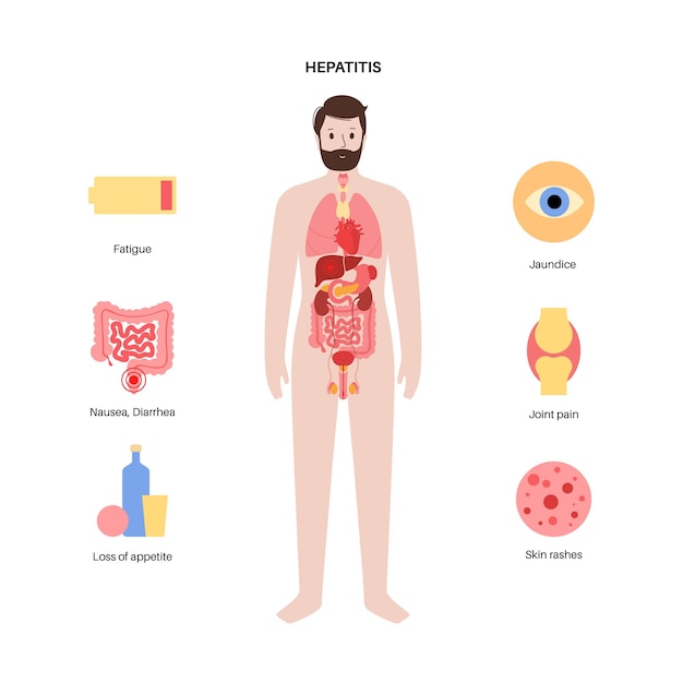 Autoimmune hepatitis disease