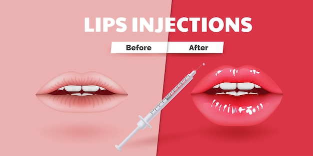 Before and after 3D vector illustration showcasing realistic lip augmentation Concept highlights