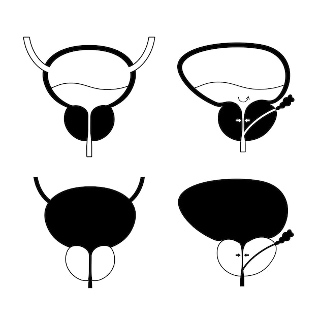 Benign prostatic hyperplasia logo for clinic.