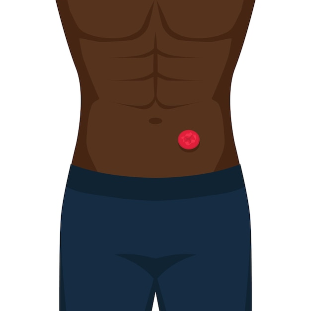 Vector black man with stoma after colon cancer surgery vector illustration