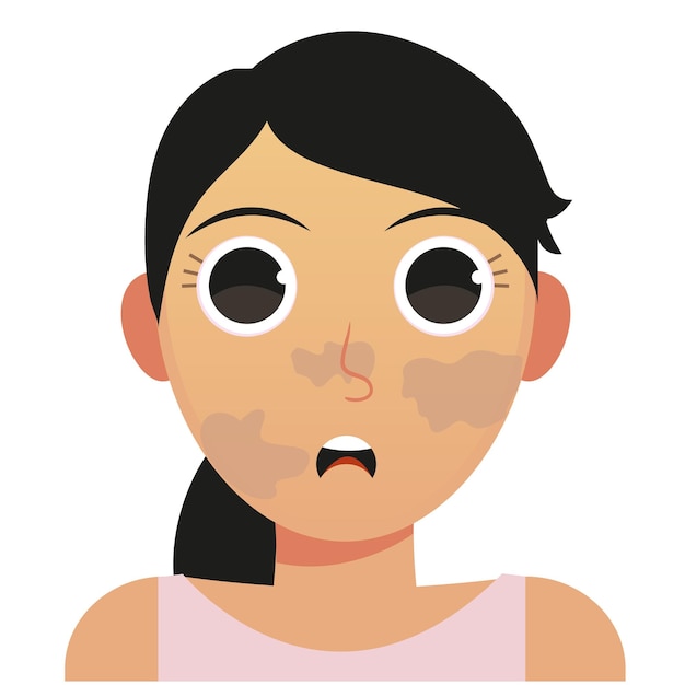 blemished skin vector