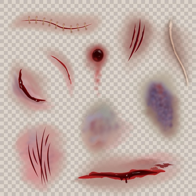 Vector bloody wounds. realistic various scars, wound and medical stitch. slaughter, torn gash and bruise, surgery or halloween close-up texture. vector isolated set on transparent background