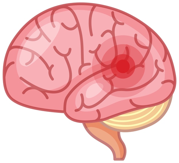 The brain has a red signal on white background