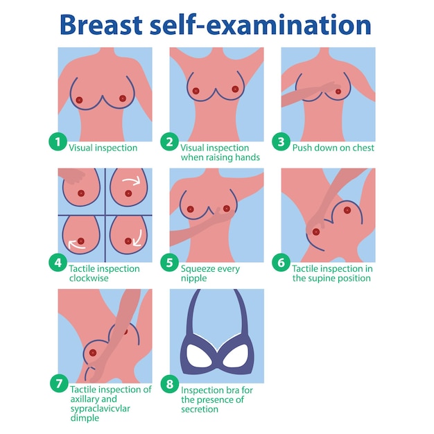 Breast selftest Phased self breast examination Mammography