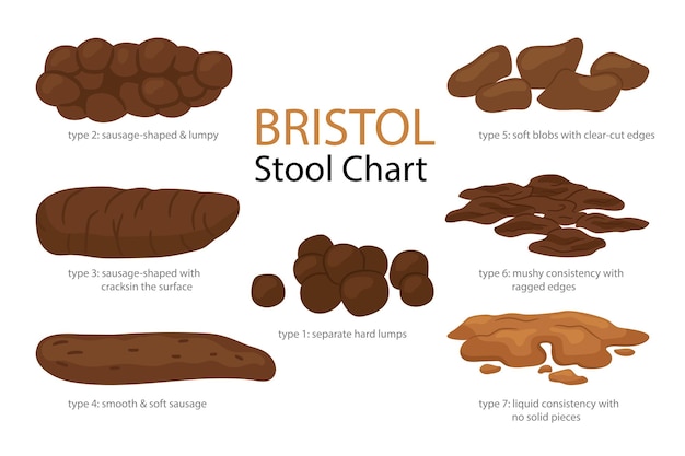 Bristol stool form scale with faeces type images Set of different types human feces excrement in normal and diseases of diarrhea and constipation