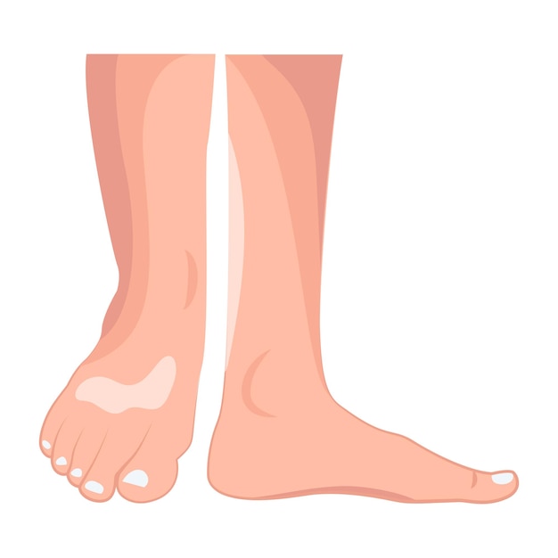 Bundle of Ladies Feet Flat Icons