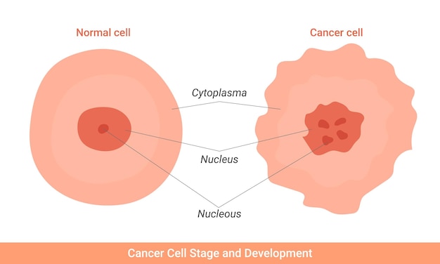 Cancer cell stage and development illustration