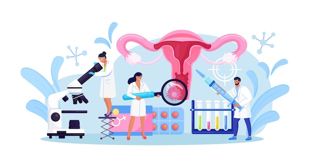 Cancer of cervix, papillomavirus. Tiny doctors examine uterus with magnifier to treat cervical cancer,  cauterize erosion, diagnosis papilloma. HPV vaccination. Gynecology, female disease