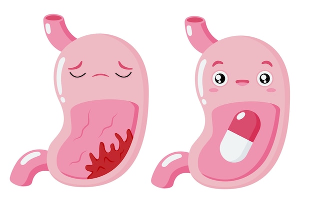 Cartoon stomach Stomach tumor Pills and medicinesHealthy and sick stomach character Gastritis