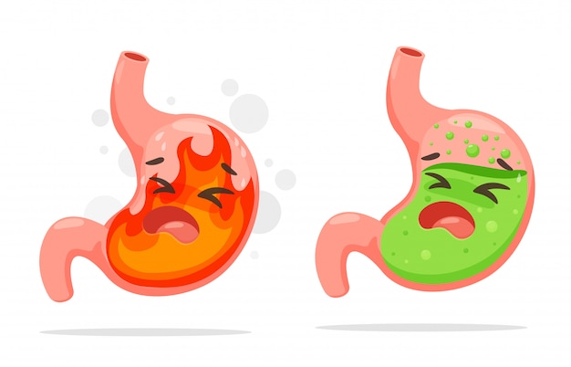 Cartoon stomach suffering from acid reflux. 