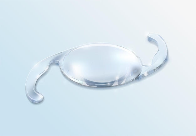 Cataract surgery intraocular lens that will restore your vision Corrective eyewear IOL