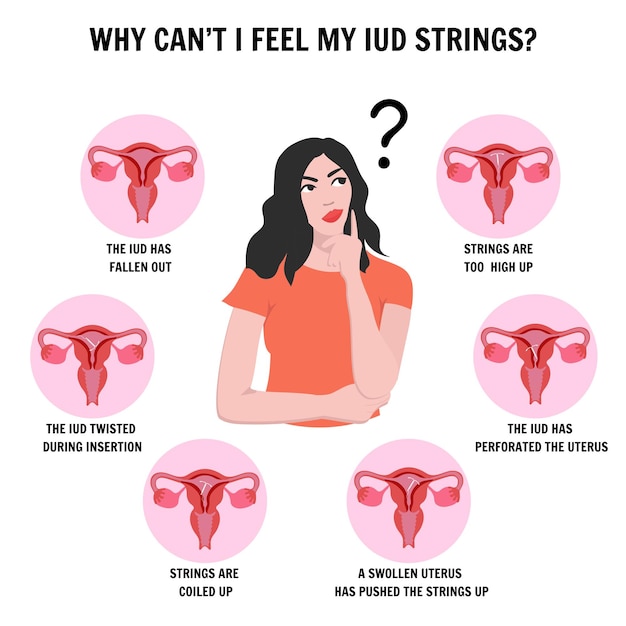 Causes not feel iud strings Intrauterine device with woman information in vector