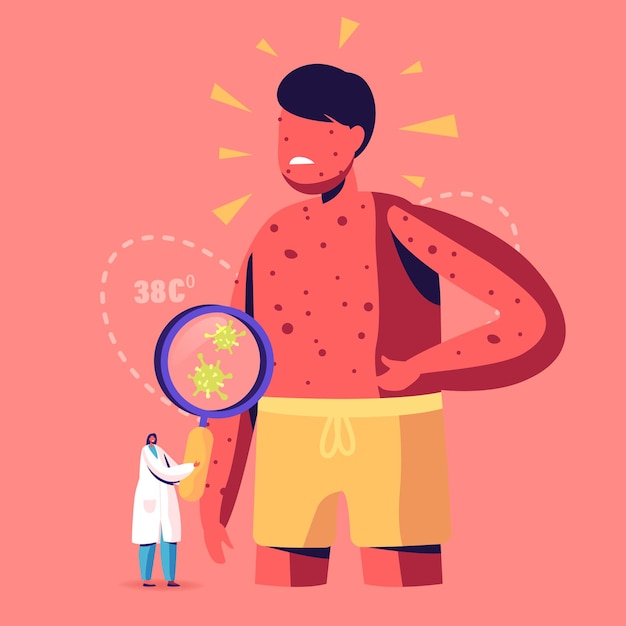 Vector chicken pox varicella symptoms concept. cartoon illustration