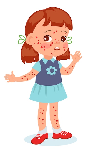 Child with chicken pox Cartoon kid with red rash