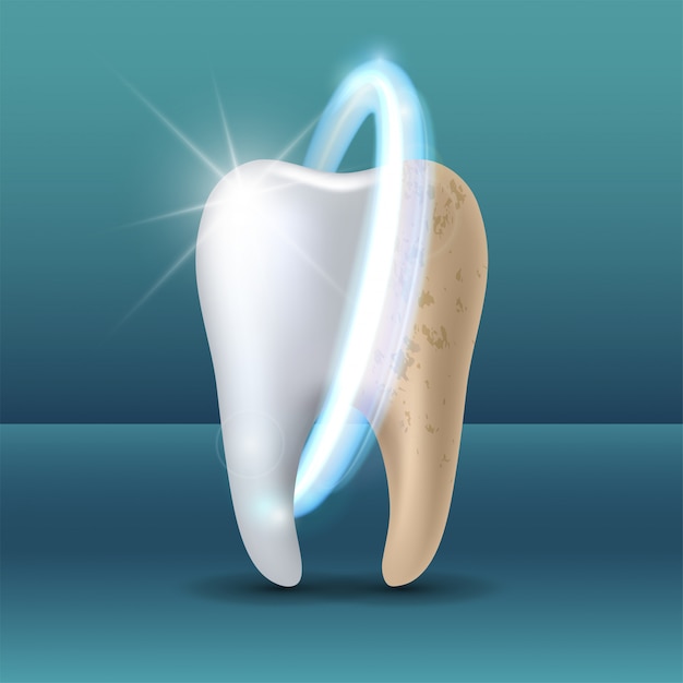 Clean and dirty tooth before and after whitening