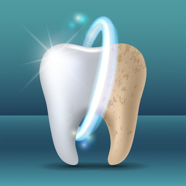 Clean and dirty tooth before and after whitening