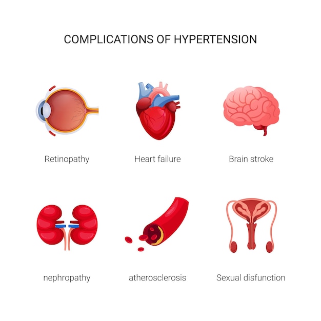 Complications of Hypertension illustration