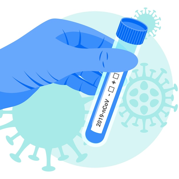 Coronavirus pcr test medical concept Vector glass tube flask in doctor hand 2019nCoV analyzes